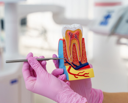 root-canal