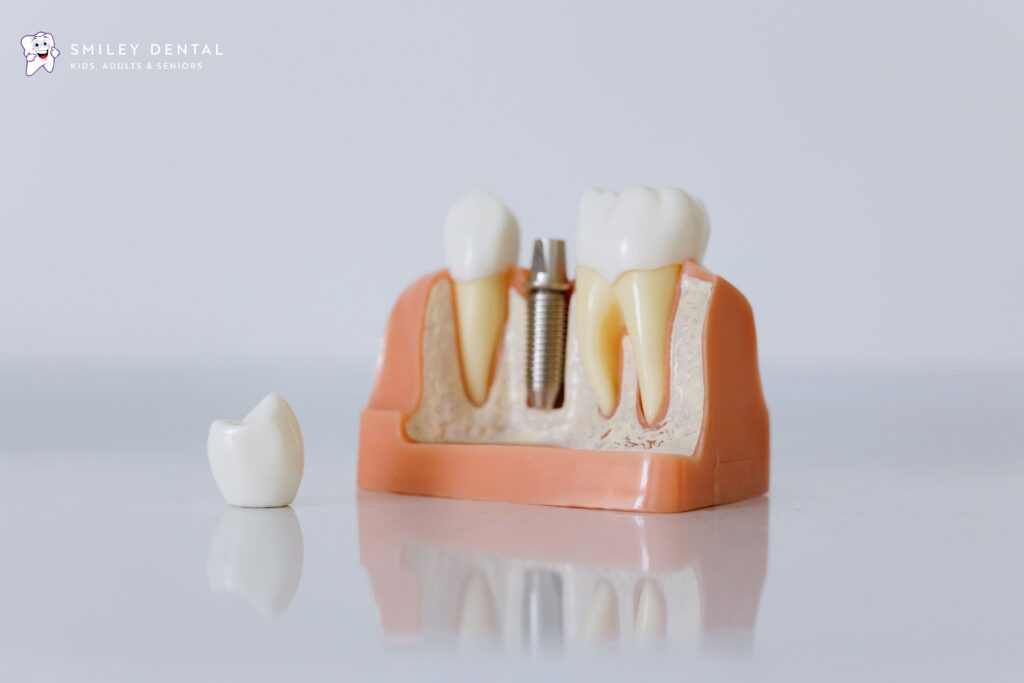 Dentist showing a dental implant and bridge model to a patient in Roslindale