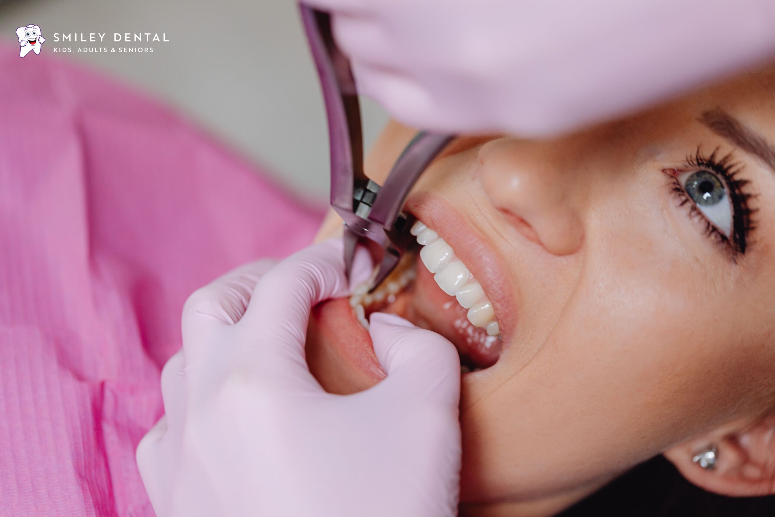 Dentist using an instrument to examine a patient's knocked-out tooth during emergency dental care