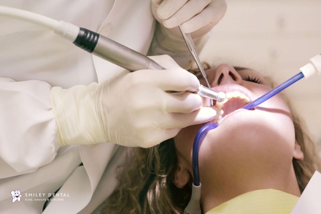 Dentist placing a tooth-colored filling during a dental procedure