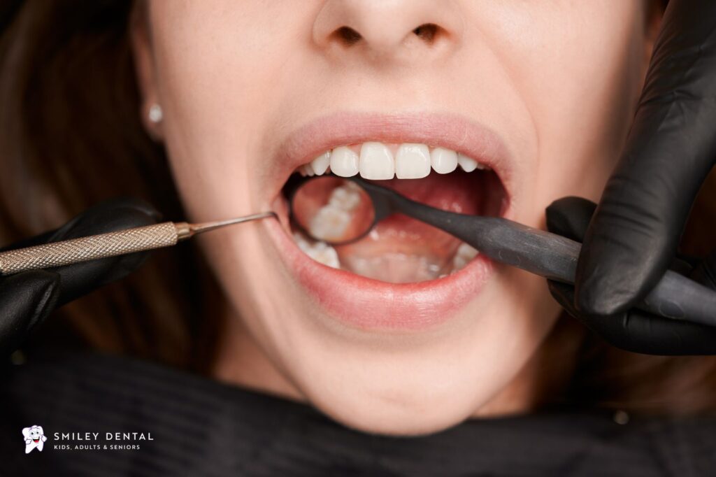 Dental examination for wisdom tooth extraction at Smiley Dental Boston